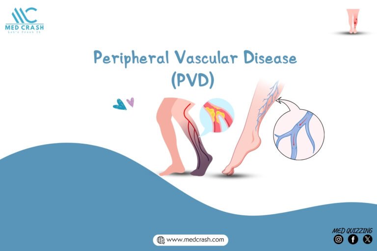 Peripheral Vascular Disease (PVD) Peripheral Arterial (PAD) Venous Disease