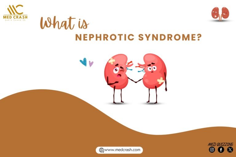 What is Nephrotic Syndrome? Causes, Sign & Symptoms